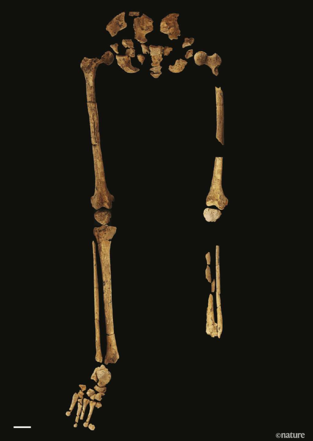 Skelet bewijst naastenliefde in het stenen&nbsp;tijdperk
